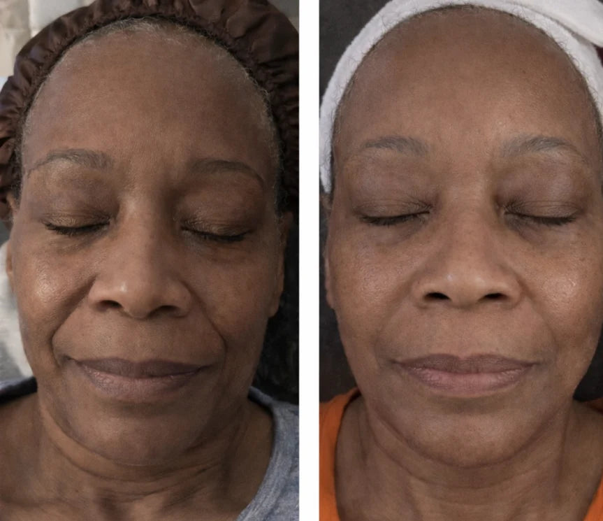 Skinaed Collagen Peptide Lifting Ampoule